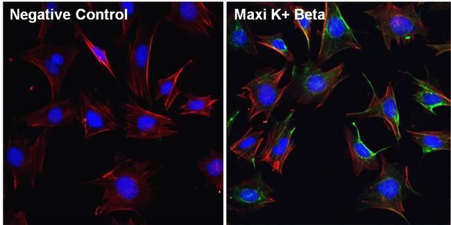 KCNMB1 antibody