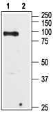 TRPV6 antibody