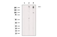 Ki67 (phospho Thr1335) antibody