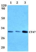 CT47 antibody
