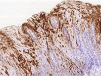 Psoriasin antibody [3E3H12F9]