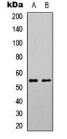SGK1 (phospho Ser78) antibody