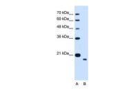 TMEM91 antibody, N-term