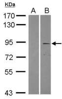 TRIM2 antibody [C3], C-term