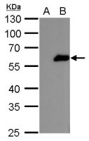 FOXJ1 antibody