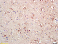 SOAT2 antibody