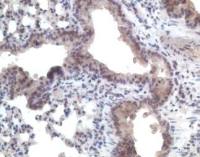 CCR11 antibody