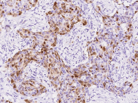 S100A8 antibody [216]