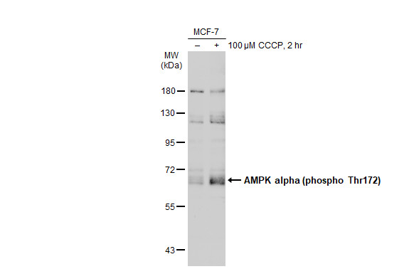 AMPK alpha 1 (phospho Thr183) + AMPK alpha 2 (phospho Thr172) antibody