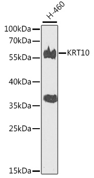 Cytokeratin 10 antibody产品图