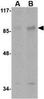 AAK1 antibody
