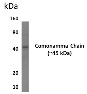 IL2 Receptor gamma antibody [6A21]