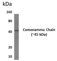 IL2 Receptor gamma antibody [6A21]