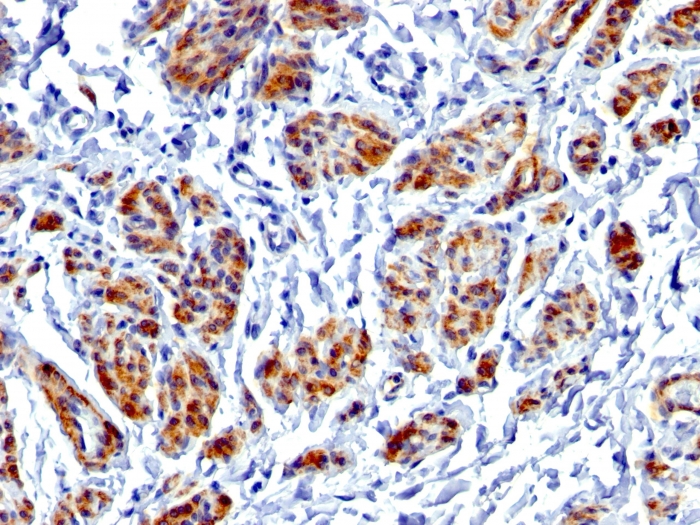 Caldesmon antibody [CALD1/1424R]