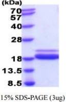 Mouse TNF alpha protein, His tag (active)