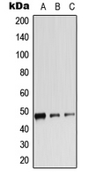 beta 2 Adrenergic Receptor (phospho Ser346) antibody
