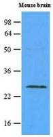 RAB5A antibody [3A4]