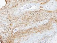 MEKK3 antibody [N3C3]