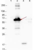 Borrelia burgdorferi Dbp-A antibody