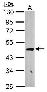 CCDC17 antibody [N3C2], Internal