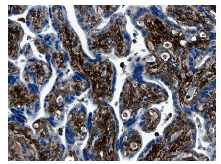 MMP7 antibody [4C21]