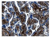 MMP7 antibody [4C21]