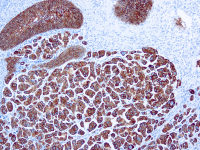 Cytokeratin 7 antibody [OV-TL 12/30]