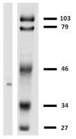 HLA-G antibody [MEM-G/2]