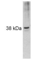 ARA9 antibody