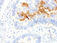 TAG72 antibody [IHC072]