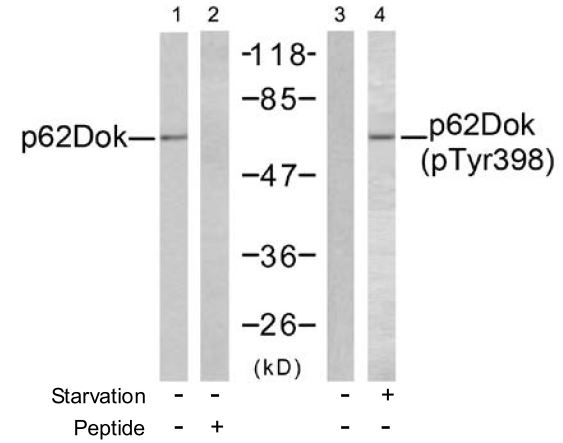 p62Dok (phospho Tyr398) antibody