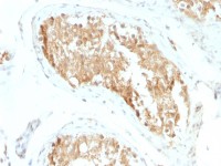 ALDH1A1 antibody [ALDH1A1/1381]