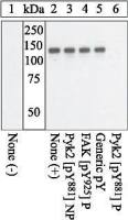 PYK2 (phospho Tyr881) antibody