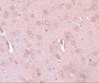 TRESK antibody