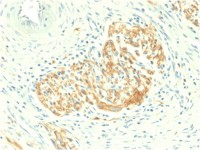 NCAM antibody [NCAM1/2217R]