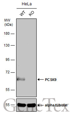 PCSK9 antibody产品图