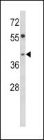 TOB2 antibody, N-term