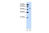 NKCC2 antibody, N-term