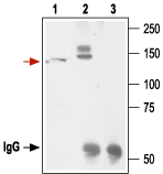 Kv11.1 antibody