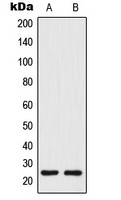 TM4SF3 / TSPAN8 antibody