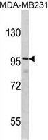 DLGAP1 antibody, N-term