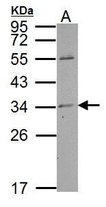 TPRG1L antibody