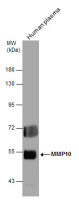 MMP10 antibody
