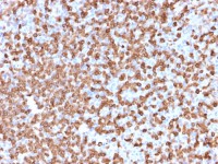 CD74 antibody [LN-2]