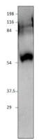 SIDT1 antibody
