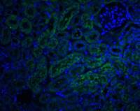 DcR2 / CD264 antibody