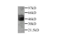 PAI-1 antibody