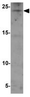 RHOG antibody