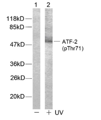 ATF2 (phospho Thr71) antibody