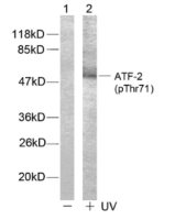 ATF2 (phospho Thr71) antibody